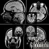 LOBOTOMY (Explicit) - KOMVEW&Мэнни Дэйс
