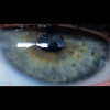 Orion Im Auge - Sam Weber