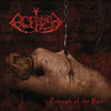 Upgrade - Eclipse