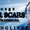 Foegz War Scars (feat. Spb newborn) (Explicit) - Foegz&SPB Newborn