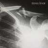 Bones Break - Ryan Michael