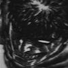 Voices Inside Me Won’t Let Me Go To Sleep (Radio Edit) - DEXXMANE