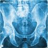 MINUTIA (Explicit) - just John&DOM DIAS