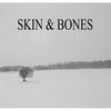 Fire (Live) - Skin & Bones