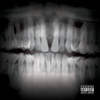Mp2m (Explicit) - Isha