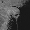 Fears - MVTRIIIX