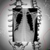 Spinal (Explicit) - Cali the Dreamer&DreCat&Truelove