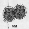 Brilliant Mind - Blanco